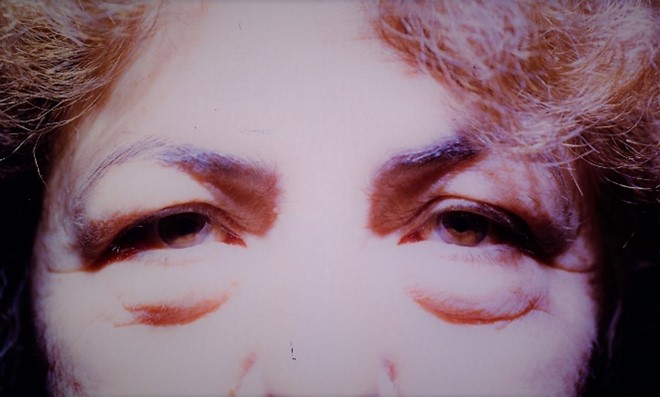 Before Laser Lower Eyelid Surgery