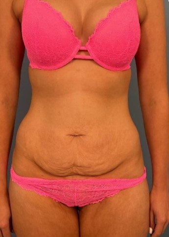 Modal Tummy Tuck Without Marks Panties Women High Waist Flat Angle