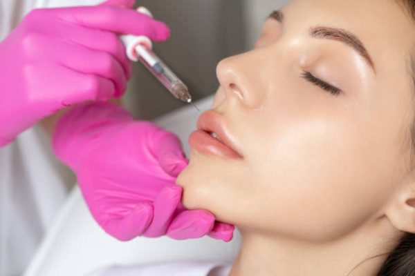 The Needle Technique of Lip Filler Injection